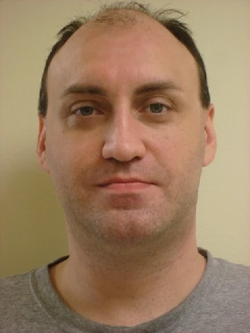 Default photograph on the Lance Fine wiki article.